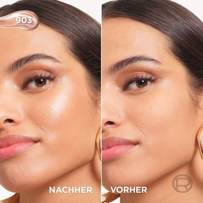 Lumi Glotion Vorher/Nachher-Vergleich