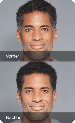 211008 MEX Vorher Nachher 1