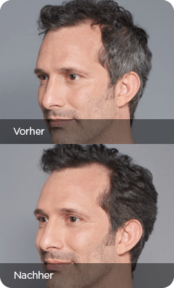 211008 MEX Vorher Nachher 2