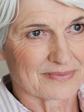 Slower Microcirculation The Consequences For My Mature Skin Article