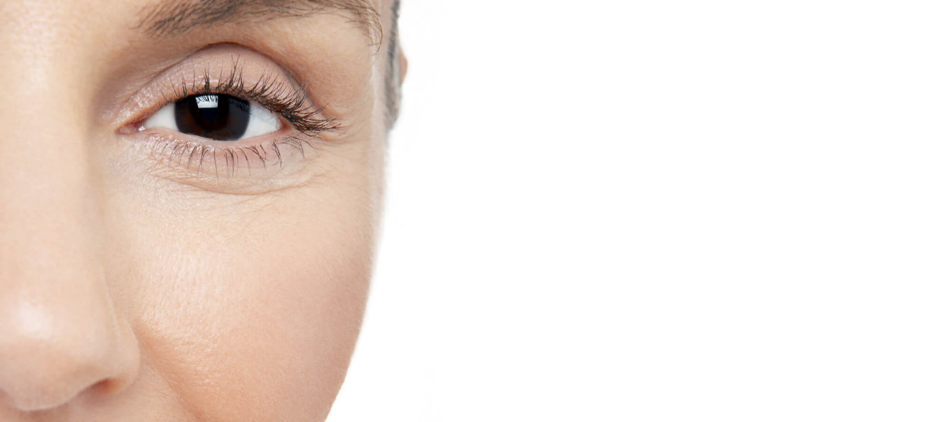 Atopic Skin True Vs False Hero