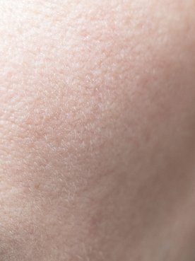 The 5 Beauty Benefits Of Glycolic Acid Article